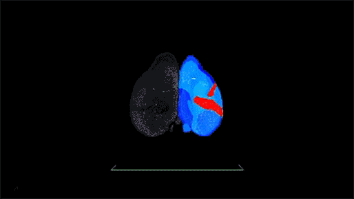Video shows a 3D image of a rotating mouse brain with a subset of cells labeled and with an overlay of anatomical boundaries.  The image is sliced in different orientations to display the interior of the brain.  The procedures allow for automatic detection of anatomical boundaries and cell counts in 3D mouse brain samples.