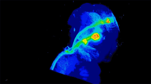 Still image of Video shows a 3D image of a rotating mouse brain. Dense cell labeling is at the front of the brain with dense fiber tracks projecting to the back of the brain and sparse fibers projecting to multiple regions. The procedures allow for a fully intact brain sample to be imaged and the path of the projections to be confirmed.