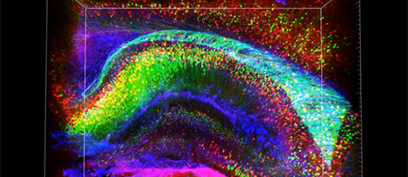 3-D Analysis of Intact Mouse Hippocampus CLARITY - cover image