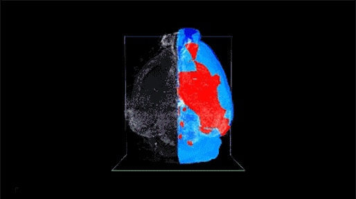 Still image of video shows a 3D image of a rotating mouse brain with a subset of cells labeled and with an overlay of anatomical boundaries.  The image is sliced in different orientations to display the interior of the brain.  The procedures allow for automatic detection of anatomical boundaries and cell counts in 3D mouse brain samples.