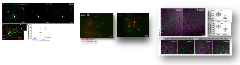 Brain cell images taken with a fluorescent microscope, reflect the different types and their unique characteristics that can be identified in various regions and changes associated with different disorders