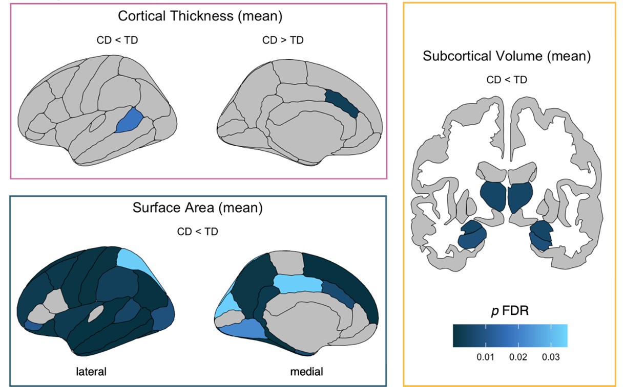 Three panels showing plots of the brain. Panel A shows mean cortical thickness, Panel B shows mean surface area, and Panel C shows mean subcortical volume.